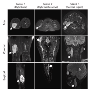 Images de la segmentation, tirées de l'article.