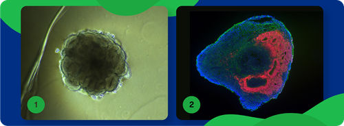 Organoïdes cérébraux en images