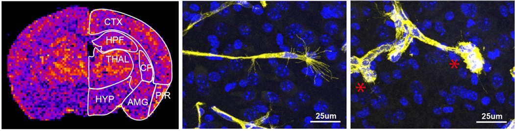 développement des vaisseaux dans le cerveau