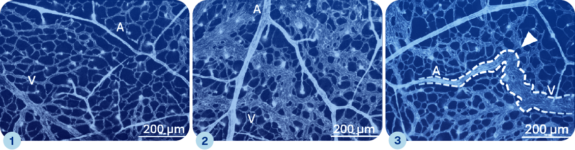 Vasculature - images d'Élise Drapé